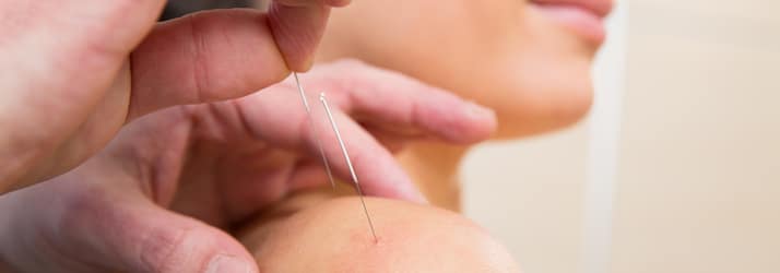 Acupuncture in Palm Beach Gardens FL